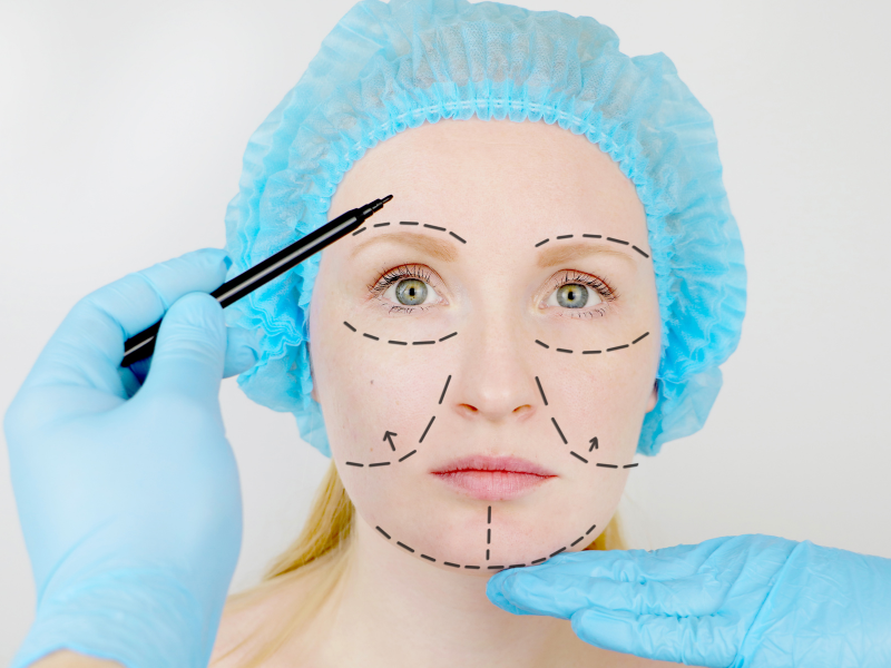 Blefaroplastia Superior e Inferior: Rejuvenescimento e Saúde para seus Olhos